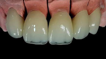 تقنية مختبرات الأسنان السعودية - جازان - +966 50 052 3657