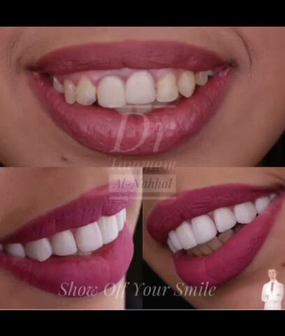 تمام النحال الدكتور تمام النحال - الخبر -