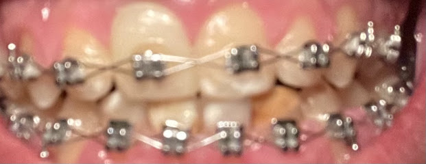 عيادة ابها سمايل لطب الاسنان - أبها - +966 17 225 1188